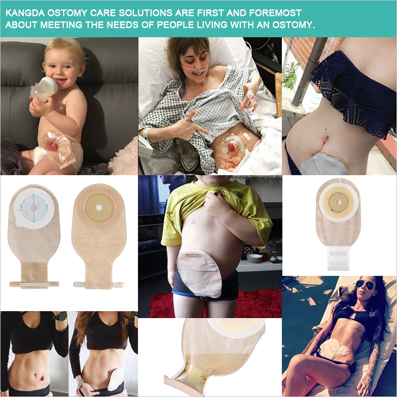 Two piece drainable colostomy bag